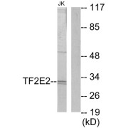 Western blot analysis of extracts from Jurkat cells, using TF2E2 antibody.