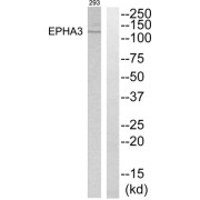 Western blot analysis of extracts from 293 cells, using EPHA3 antibody.