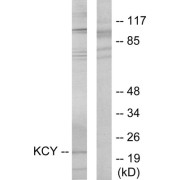 Western blot analysis of extracts from HeLa cells, using KCY antibody.