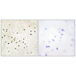 General Transcription Factor IIH Subunit 1 (TF2H1) Antibody