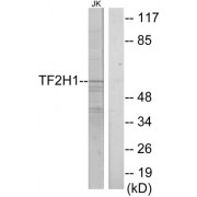 Western blot analysis of extracts from Jurkat cells, using TF2H1 antibody.