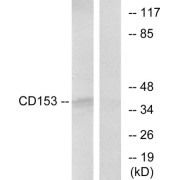 Western blot analysis of extracts from RAW264.7 cells, using CD153 antibody.