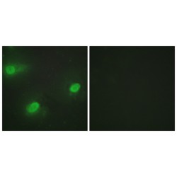 Cleavage Stimulation Factor Subunit 2 (CSTF2) Antibody