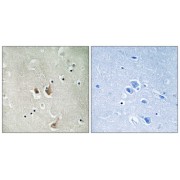 Immunohistochemistry analysis of paraffin-embedded human brain tissue, using CKS2 antibody.