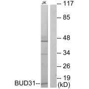 Western blot analysis of extracts from Jurkat cells, using BUD31 antibody.