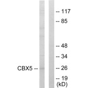 Western blot analysis of extracts from HUVEC cells, using CBX5 antibody.