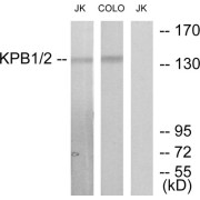 Western blot analysis of extracts from Jurkat cells and COLO205 cells, using KPB1/2 antibody.