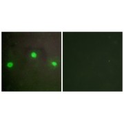 Immunofluorescence analysis of A549 cells, using ATRX antibody.