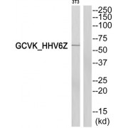 Western blot analysis of extracts from 3T3cells, using MAP2K3 antibody.