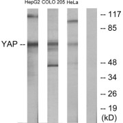 Western blot analysis of extracts from HepG2 cells, COLO205 cells and HeLa cells, using YAP antibody.