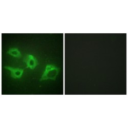 Casein Kinase I Isoform Alpha (CSNK1A1) Antibody