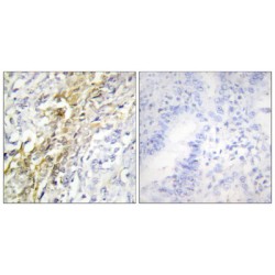 Casein Kinase I Isoform Alpha (CSNK1A1) Antibody