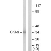 Western blot analysis of extracts from HeLa cells, using CKI-alpha antibody. The lane on the right is blocked with the synthesized peptide.