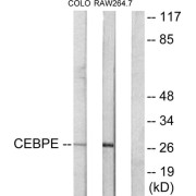 Western blot analysis of extracts from LOVO cells and RAW264.7 cells, using C/EBP delta/epsilon antibody.