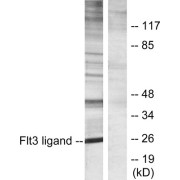 Western blot analysis of extracts from Jurkat cells, using Flt3 ligand antibody.