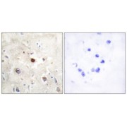 Immunohistochemistry analysis of paraffin-embedded human brain tissue, using p57KIP2 antibody.