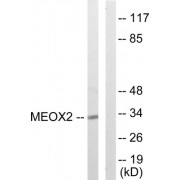 Western blot analysis of extracts from COLO205 cells, using MEOX2 antibody.