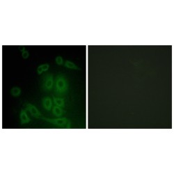 Fragile X Mental Retardation, Autosomal Homolog 2 (FXR2) Antibody