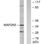 Western blot analysis of extracts from 293 cells, using MAP2K6 antibody.