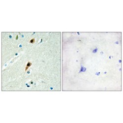 RNA Binding Motif Protein 5 (RBM5) Antibody