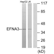 Western blot analysis of extracts from HepG2 cells and Jurkat cells, using EFNA3 antibody.