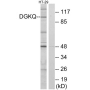 Western blot analysis of extracts from HT-29 cells, using DGKQ antibody.