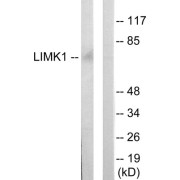 Western blot analysis of extracts from mouse brain cells, using LIMK1 antibody.