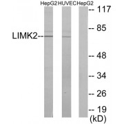 Western blot analysis of extracts from HepG2 cells and HUVEC cells, using LIMK2 antibody.