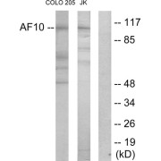 Western blot analysis of extracts from COLO205 cells and Jurkat cells, using AF10 antibody.