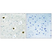Immunohistochemistry analysis of paraffin-embedded human brain tissue, using TPD52 antibody.