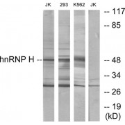 Western blot analysis of extracts from Jurkat cells, 293 cells and K562 cells, using hnRNP H antibody.