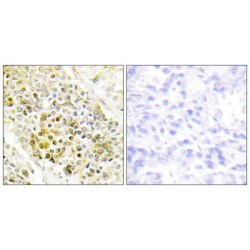 Distal-Less Homeobox 5 (DLX5) Antibody