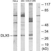 Western blot analysis of extracts from HeLa cells, 293 cells and COLO205 cells, using DLX5 antibody.