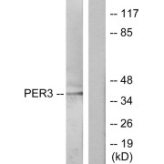 Western blot analysis of extracts from Jurkat cells, treated with insulin (0.01U/ml, 15mins), using PER3 antibody.