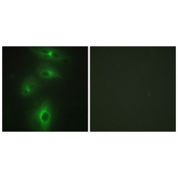 Transmembrane Protease, Serine 3 (TMPRSS3) Antibody