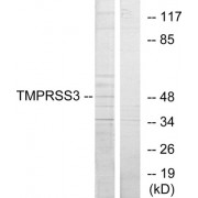 Western blot analysis of extracts from HUVEC cells, using TMPRSS3 antibody.