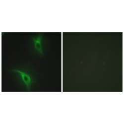 Cyclin-Dependent Kinases Regulatory Subunit 1 (CKS1) Antibody