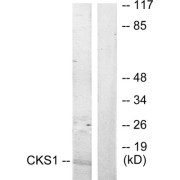 Western blot analysis of extracts from Jurkat cells, treated with serum (20%, 15mins), using CKS1 antibody.