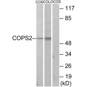 Western blot analysis of extracts from COS-7 cells and COLO205 cells, using COPS2 antibody.