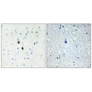 Immunohistochemistry analysis of paraffin-embedded human brain tissue, using TPD52 antibody.