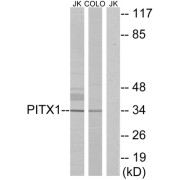 Western blot analysis of extracts from Jurkat cells and COLO cells, using PITX1 antibody.