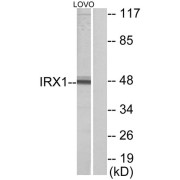 Western blot analysis of extracts from LOVO cells, using IRX1 antibody.