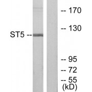 Western blot analysis of extracts from COLO205 cells, using ST5 antibody.