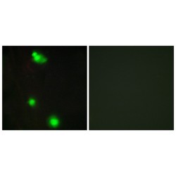 Splicing Factor, Arginine/serine-Rich 3 (SFRS3) Antibody