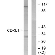 Western blot analysis of extracts from COLO205 cells, using CDKL1 antibody.