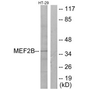 Western blot analysis of extracts from HT-29 cells, using MEF2B antibody.