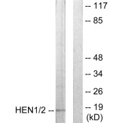 Western blot analysis of extracts from Jurkat cells, using HEN1/2 antibody.