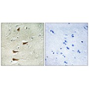 Immunohistochemistry analysis of paraffin-embedded human brain tissue, using MAP3K10 antibody.