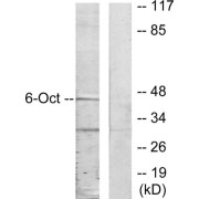 Western blot analysis of extracts from A549 cells, using OCT6 antibody.