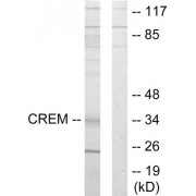 Western blot analysis of extracts from K562 cells, using CREM antibody.